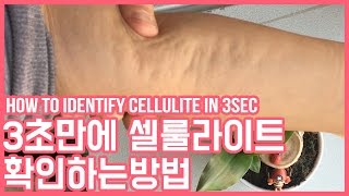 3초만에 내 몸 속 셀룰라이트 확인하는 방법(How To Identify Cellulite In 3Sec) - Youtube