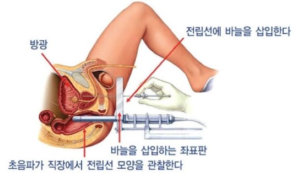 요도자위 이론편 #1 요도자위의 정의: 요도자위란? - 요도자위 바이블 | 성인용품 바나나몰